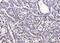 26S proteasome non-ATPase regulatory subunit 8 antibody, A12465-1, Boster Biological Technology, Immunohistochemistry paraffin image 