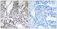 Pleckstrin Homology Like Domain Family A Member 3 antibody, abx014056, Abbexa, Western Blot image 