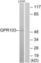 Pyroglutamylated RFamide peptide receptor antibody, abx015472, Abbexa, Western Blot image 