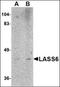Ceramide Synthase 6 antibody, orb88701, Biorbyt, Western Blot image 