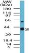 Glutathione-Disulfide Reductase antibody, PA5-23247, Invitrogen Antibodies, Western Blot image 