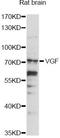 VGF Nerve Growth Factor Inducible antibody, LS-C749775, Lifespan Biosciences, Western Blot image 