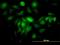 Ftl antibody, H00002512-M16, Novus Biologicals, Immunocytochemistry image 