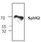 Sphingosine kinase 2 antibody, TA318992, Origene, Western Blot image 