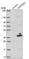 Ankyrin Repeat Domain 29 antibody, NBP2-33564, Novus Biologicals, Western Blot image 