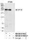 Kinesin Family Member 1B antibody, NB100-57494, Novus Biologicals, Western Blot image 