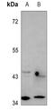 Ras Related GTP Binding A antibody, GTX55848, GeneTex, Western Blot image 