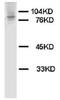 HIF-2-alpha antibody, AP23352PU-N, Origene, Western Blot image 