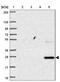 PHD Finger Protein 21B antibody, NBP2-30660, Novus Biologicals, Western Blot image 