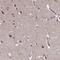 Disco Interacting Protein 2 Homolog B antibody, NBP2-14563, Novus Biologicals, Immunohistochemistry frozen image 