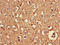 Ras antibody, orb49058, Biorbyt, Immunohistochemistry paraffin image 