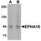 EPH Receptor A10 antibody, NBP1-76318, Novus Biologicals, Western Blot image 