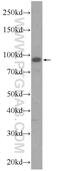 Zinc Finger Protein 746 antibody, 24543-1-AP, Proteintech Group, Western Blot image 