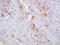 C-C Motif Chemokine Receptor 2 antibody, 250580, Abbiotec, Immunohistochemistry paraffin image 