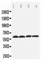 Solute Carrier Family 22 Member 7 antibody, PA5-80018, Invitrogen Antibodies, Western Blot image 