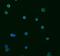 SS-A antibody, MAB6219, R&D Systems, Immunocytochemistry image 