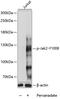Janus Kinase 2 antibody, A00027Y1008, Boster Biological Technology, Western Blot image 