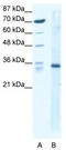 Kruppel Like Factor 3 antibody, TA330189, Origene, Western Blot image 
