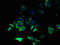 Cytochrome B-245 Chaperone 1 antibody, orb36472, Biorbyt, Immunofluorescence image 