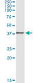 Homeobox D1 antibody, LS-C197448, Lifespan Biosciences, Immunoprecipitation image 