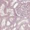 RAB3C, Member RAS Oncogene Family antibody, HPA048156, Atlas Antibodies, Immunohistochemistry paraffin image 