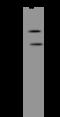 Divergent Protein Kinase Domain 2B antibody, 204713-T32, Sino Biological, Western Blot image 