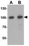 SID1 transmembrane family member 2 antibody, GTX17188, GeneTex, Western Blot image 