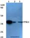 Cathepsin L antibody, A01589, Boster Biological Technology, Western Blot image 