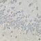 Protein Kinase AMP-Activated Non-Catalytic Subunit Beta 2 antibody, 14-931, ProSci, Immunohistochemistry paraffin image 