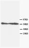 Serine/threonine-protein phosphatase 2B catalytic subunit alpha isoform antibody, AM20596PU-N, Origene, Western Blot image 
