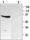 Transient Receptor Potential Cation Channel Subfamily C Member 4 antibody, TA328734, Origene, Western Blot image 