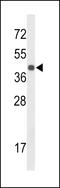 Centromere protein K antibody, 63-891, ProSci, Western Blot image 