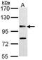 Ubiquitin carboxyl-terminal hydrolase CYLD antibody, PA5-29795, Invitrogen Antibodies, Western Blot image 