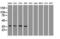 Pancreatic And Duodenal Homeobox 1 antibody, GTX83918, GeneTex, Western Blot image 