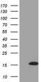 Saitohin antibody, TA810382, Origene, Western Blot image 