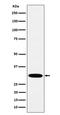 Hydroxymethylglutaryl-CoA lyase, mitochondrial antibody, M01886, Boster Biological Technology, Western Blot image 