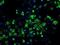 Hydroxysteroid 17-Beta Dehydrogenase 10 antibody, NBP2-02118, Novus Biologicals, Immunocytochemistry image 