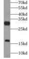 Gastrin Releasing Peptide antibody, FNab06798, FineTest, Western Blot image 