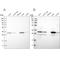 2,4-Dienoyl-CoA Reductase 1 antibody, NBP1-85264, Novus Biologicals, Western Blot image 