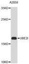UBE2I antibody, abx127072, Abbexa, Western Blot image 