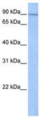 SUN domain-containing protein 1 antibody, TA339546, Origene, Western Blot image 