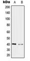 Pre-MRNA Processing Factor 18 antibody, orb214805, Biorbyt, Western Blot image 