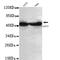Keratin 7 antibody, LS-C178334, Lifespan Biosciences, Western Blot image 