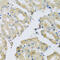 ATP Binding Cassette Subfamily F Member 2 antibody, 19-352, ProSci, Immunohistochemistry paraffin image 