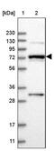 Mannosidase Alpha Class 1A Member 2 antibody, PA5-56974, Invitrogen Antibodies, Western Blot image 
