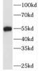 TATA-Box Binding Protein Associated Factor 7 antibody, FNab08488, FineTest, Western Blot image 