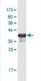 Disks large-associated protein 1 antibody, H00009229-M02-100ug, Novus Biologicals, Western Blot image 