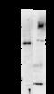 Amphiphysin antibody, orb67282, Biorbyt, Western Blot image 
