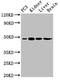 Lpap antibody, CSB-PA889072LA01HU, Cusabio, Western Blot image 