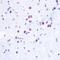 Histone Cluster 3 H3 antibody, GTX54109, GeneTex, Immunohistochemistry paraffin image 